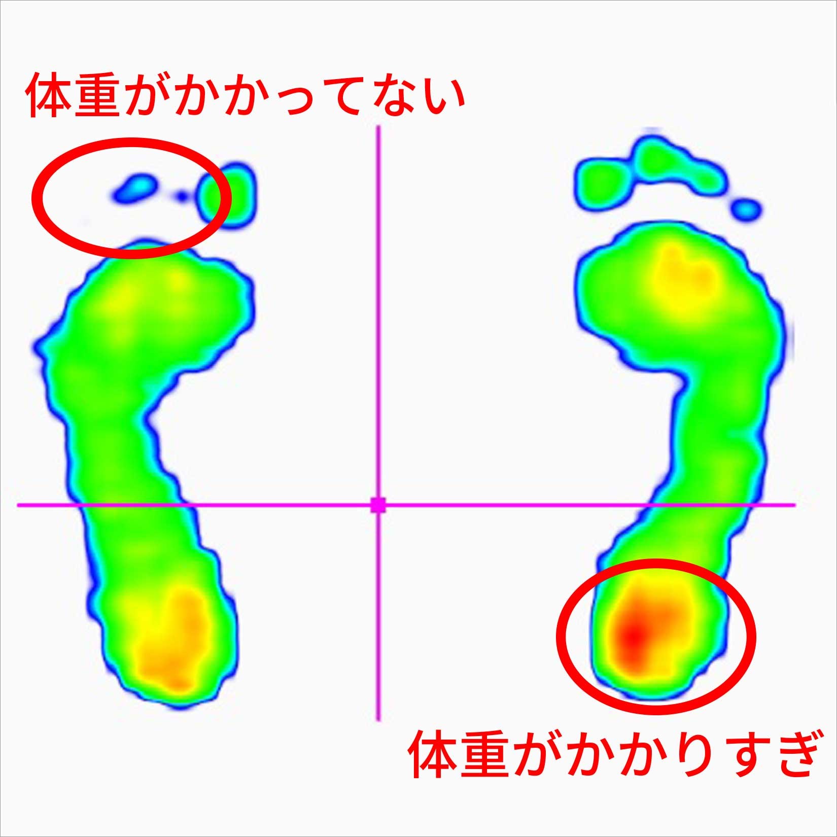 sokuteiatsu_balance.jpg