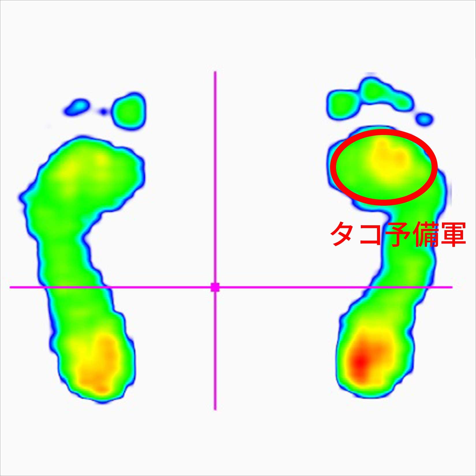 sokuteiatsu_tako.jpg