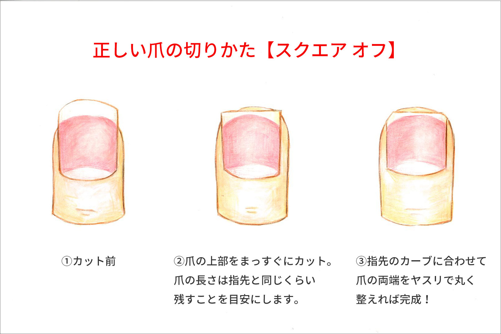 巻き爪の予防にも 正しい爪の切り方講座 コラム 足のちえぶくろ ケアソク Care Soku 株式会社山忠