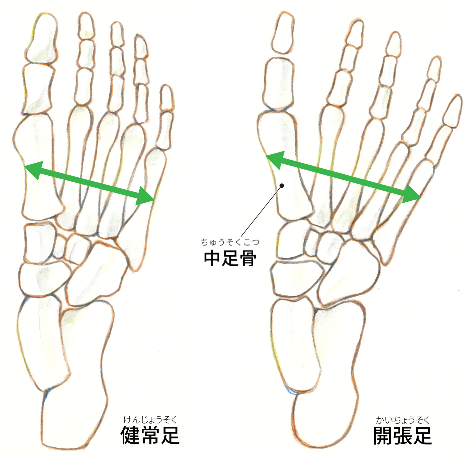 足の骨、中足骨の場所