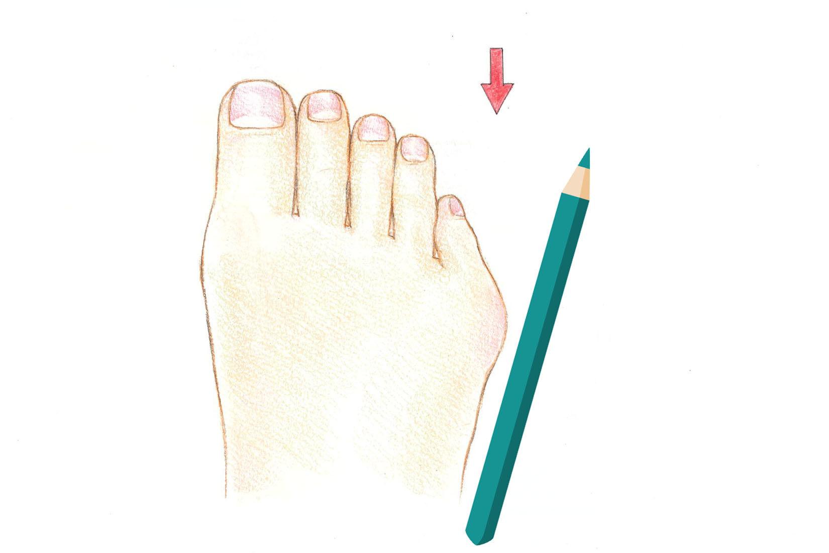 内反小趾のセルフチェック方法