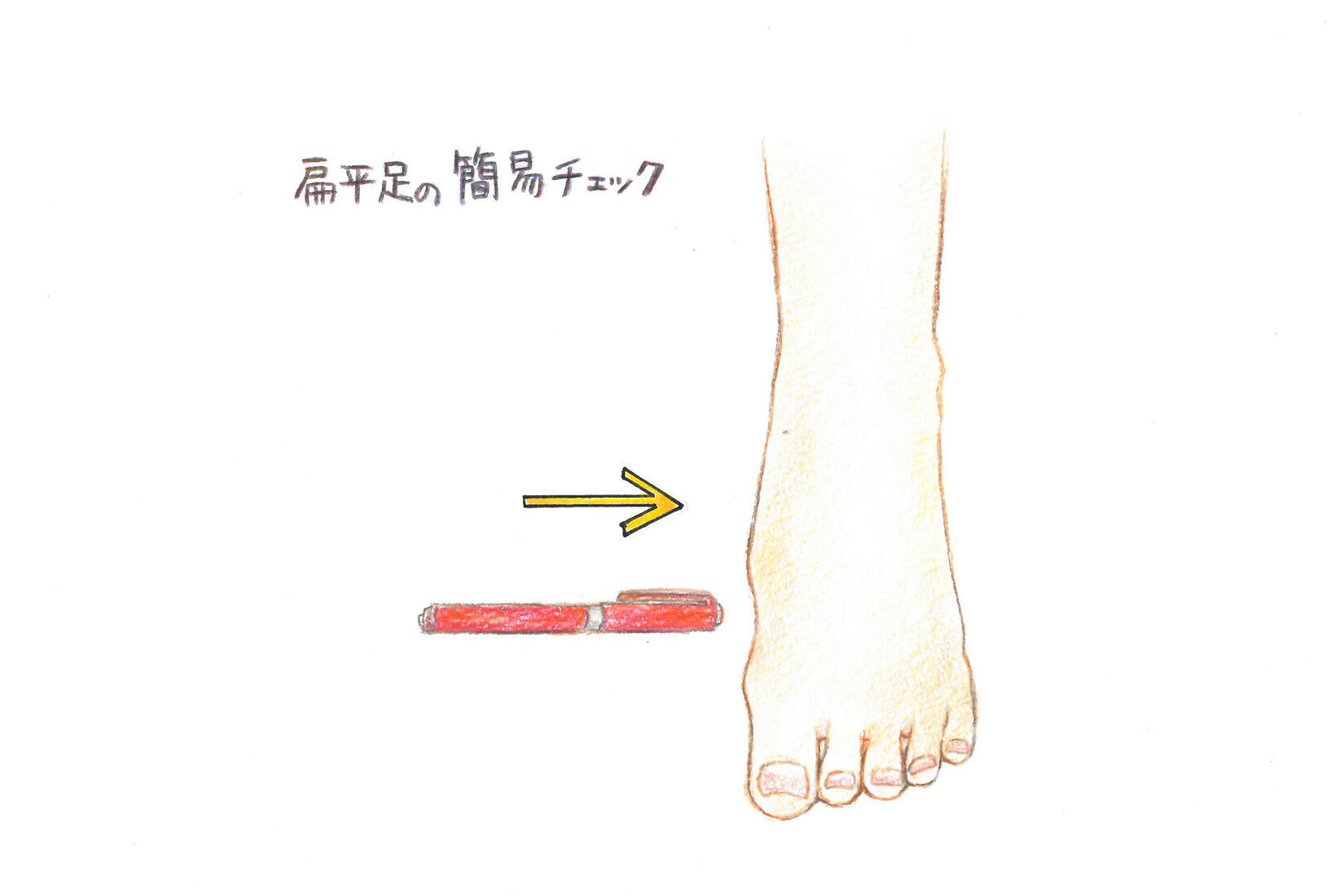 扁平足の簡単セルフチェック方法