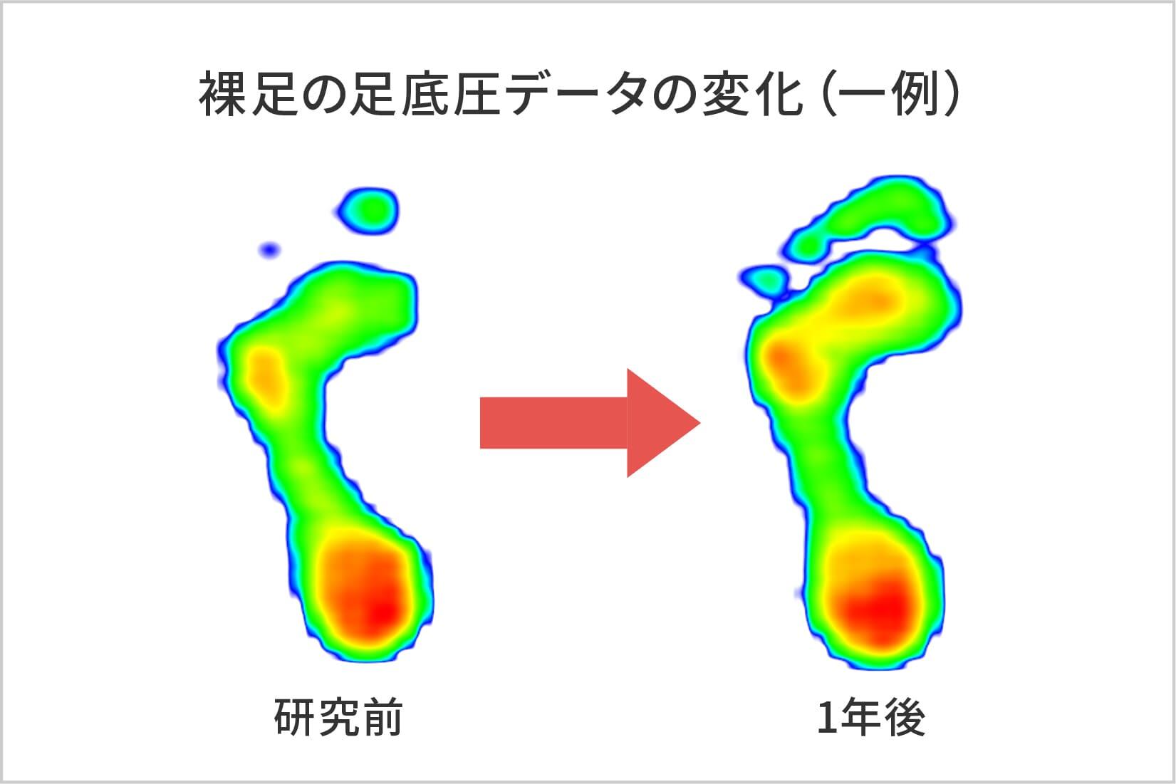 ケアソクの継続で、未来の足が変わる!?